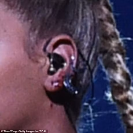Beyonce bieu dien voi mot ben tai chay mau - Anh 4