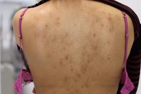Lan da bi pha huy vi thoi quen dung dau dua sai cach cua hang nghin chi em - Anh 3