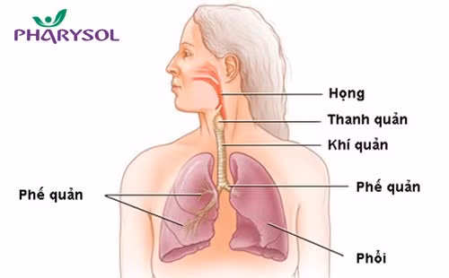 Vì sao chữa viêm họng mãi không khỏi ? - ảnh 1