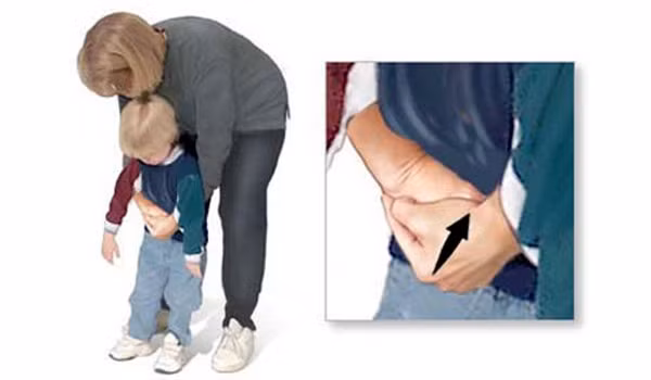 4 phút vàng cha mẹ nên biết để cứu trẻ bị hóc, nghẹn thực phẩm