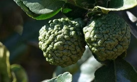 Chanh hình não người Chanh hình não người