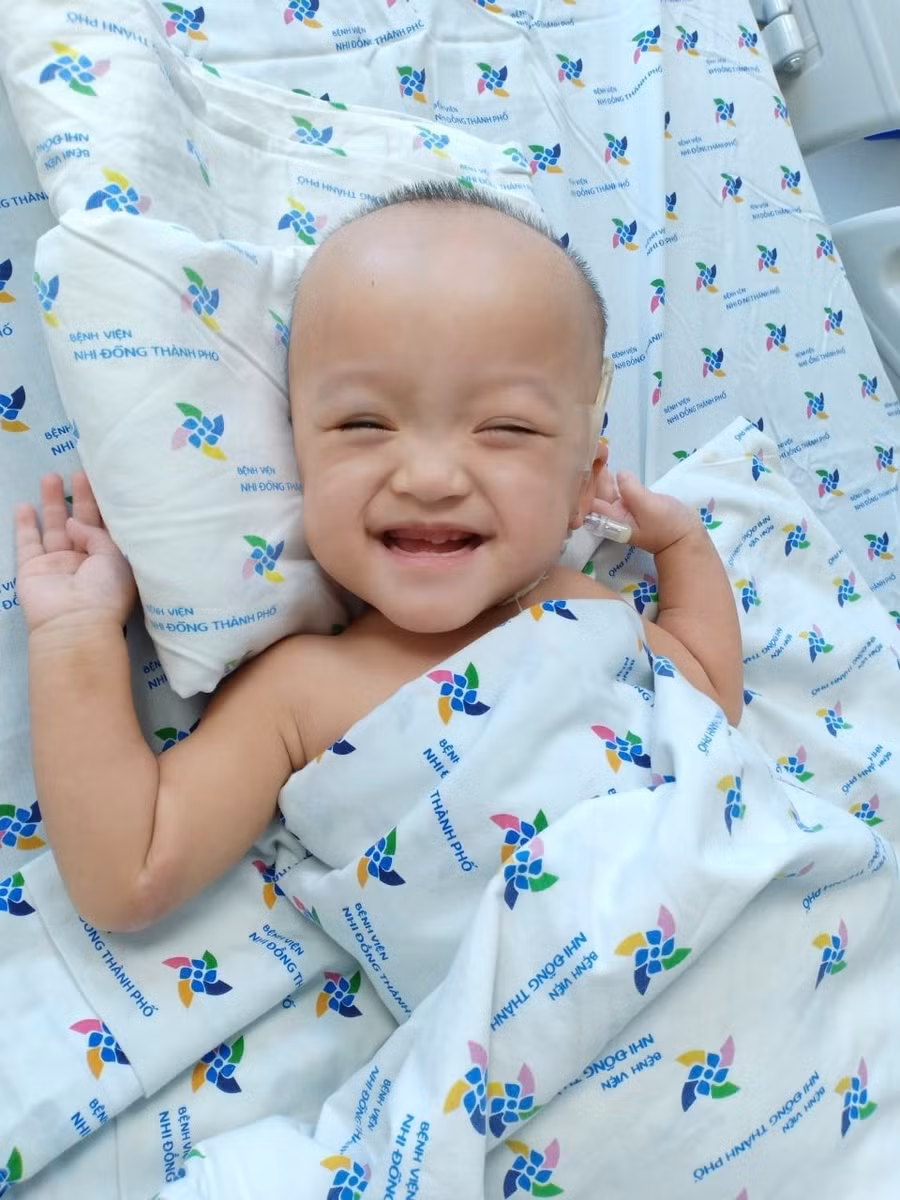 Trúc Nhi - Diệu Nhi dự kiến được tập đi sau 5 tuần. Ảnh: Bệnh viện cung cấp.