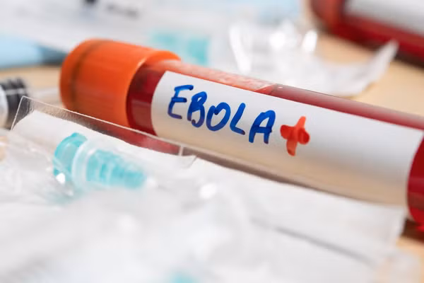 Theo Bộ Y tế, bệnh do virus Ebola là bệnh truyền nhiễm cấp tính nguy hiểm, có khả năng bùng phát thành dịch lớn với tỉ lệ tử vong trung bình khoảng 50%. Ảnh minh họa. 