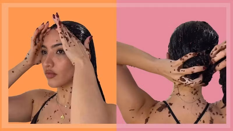 botox-1.jpg