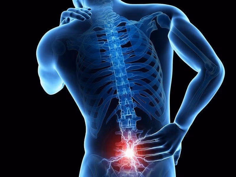 đau rễ thần kinh cột sống