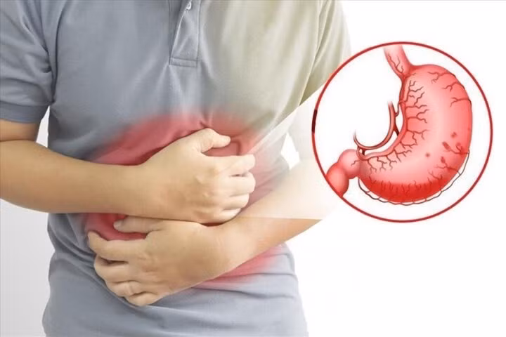 xung huyết dạ dày là gì