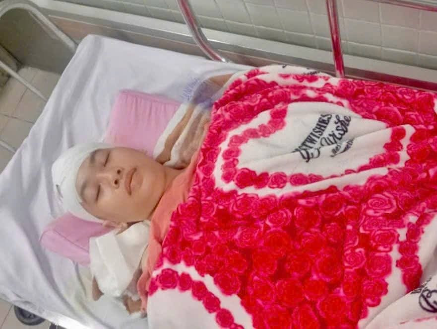 Nữ sinh lớp 11 bị u não phải 2 lần phẫu thuật điều trị.