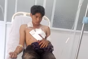 Thuât được các y bác sĩ theo dõi, điều trị sau vụ nổ mìn.