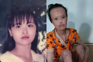 Đẫm nước mắt trước tình cảnh của cô giáo bạc mệnh 