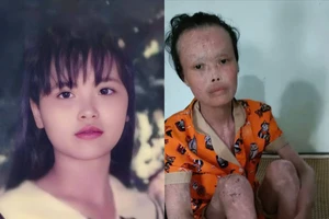 Đẫm nước mắt trước tình cảnh của cô giáo bạc mệnh 