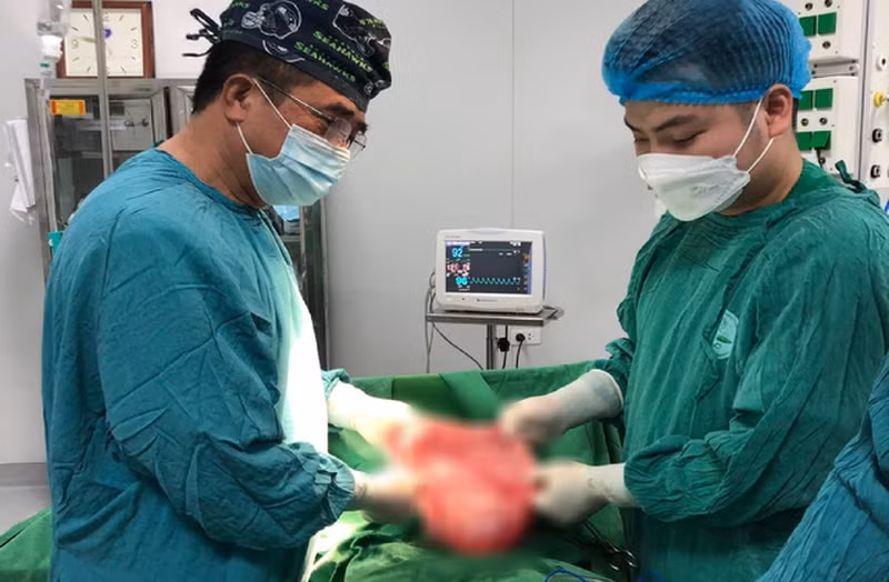 Bác sĩ cắt bỏ khối u cho bệnh nhân. Ảnh: BV.