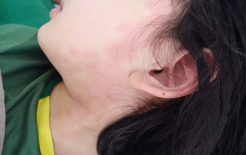 Hai bệnh nhi ở Quảng Ninh mắc hội chứng hậu Covid-19 hiếm gặp ảnh 1