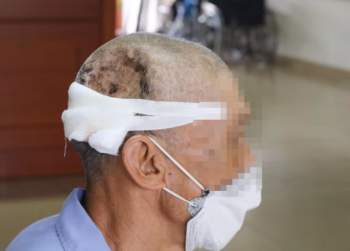 Người bệnh sau phẫu thuật.