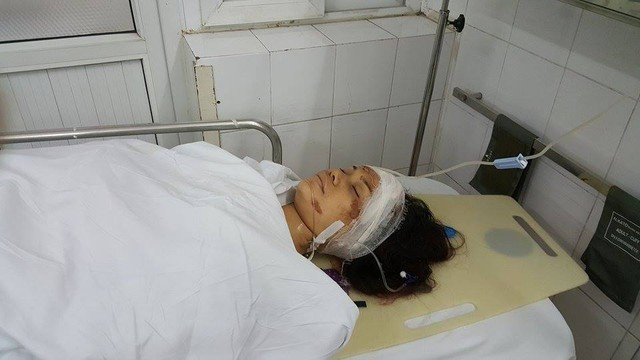 Nạn nhân Hằng của vụ sập nhà đang điều trị tại BV Việt Đức Ảnh Dantri Nạn nhân Hằng của vụ sập nhà đang điều trị tại BV Việt Đức Ảnh Dantri