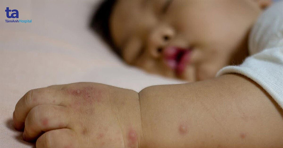 Ảnh minh họa. Ảnh minh họa.