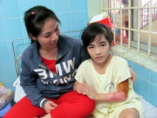 Ngủ mê mệt, chân cháy đen không hay ảnh 2 Ngủ mê mệt, chân cháy đen không hay