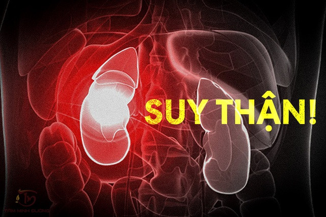 Viên uống trắng da không rõ nguồn gốc có thể làm suy thận Viên uống trắng da không rõ nguồn gốc có thể làm suy thận