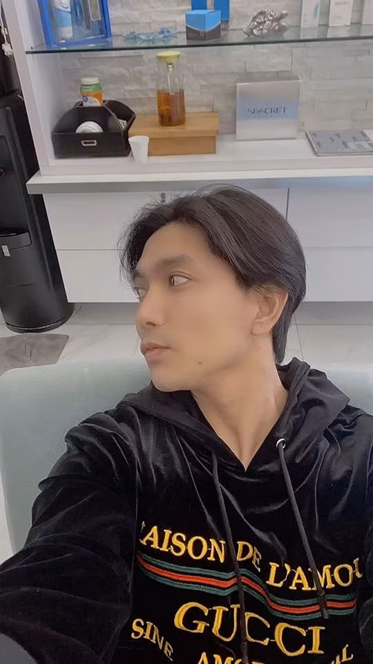 Tim xuất hiện với gương mặt khác lạ như vừa thẩm mỹ ảnh 3