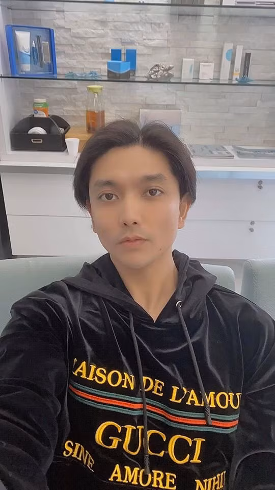 Tim xuất hiện với gương mặt khác lạ như vừa thẩm mỹ ảnh 2