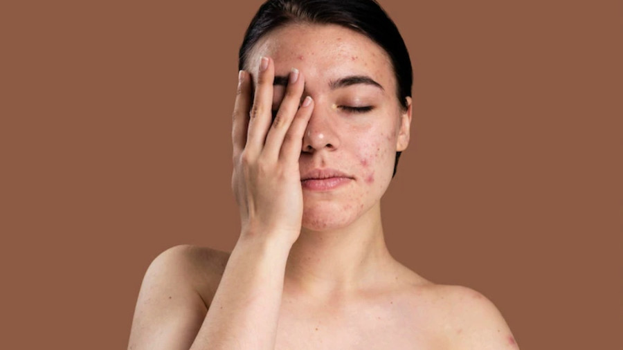 Bác sĩ khuyên rửa mặt với sữa rửa mặt ngày một lần vào buổi tối và rửa nhẹ lại với nước vào buổi sáng.