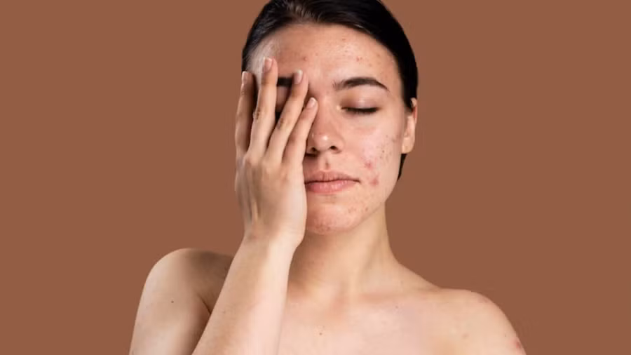 Bác sĩ khuyên rửa mặt với sữa rửa mặt ngày một lần vào buổi tối và rửa nhẹ lại với nước vào buổi sáng.