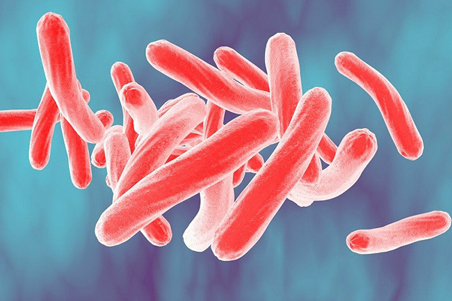 Vi khuẩn Mycobacterium tuberculosis – tác nhân gây ra bệnh lao. Ảnh minh họa.