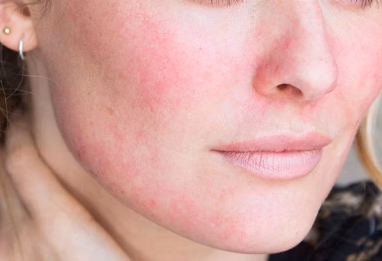 Ngứa mạn tính có thể ảnh hưởng đến tâm trạng và giấc ngủ từ đó làm giảm chất lượng cuộc sống của họ. Ảnh minh họa.