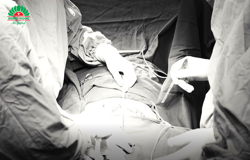 Các bác sĩ thực hiện phẫu thuật ung thư cổ tử cung cho bệnh nhân.