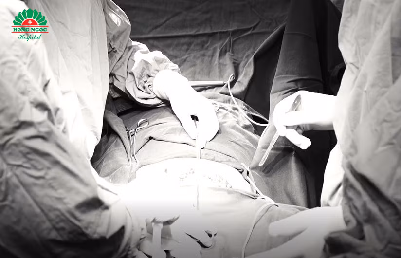 Các bác sĩ thực hiện phẫu thuật ung thư cổ tử cung cho bệnh nhân.