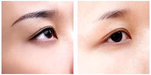 xam xong long may, co gai khoc thet khong dam lo mat ra khoi nha nhin ai - 14