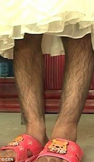 Kỳ dị cô bé 8 tuổi mắc chứng bệnh “người sói” - Ảnh 2 Kỳ dị cô bé 8 tuổi mắc chứng bệnh “người sói” - Ảnh 2