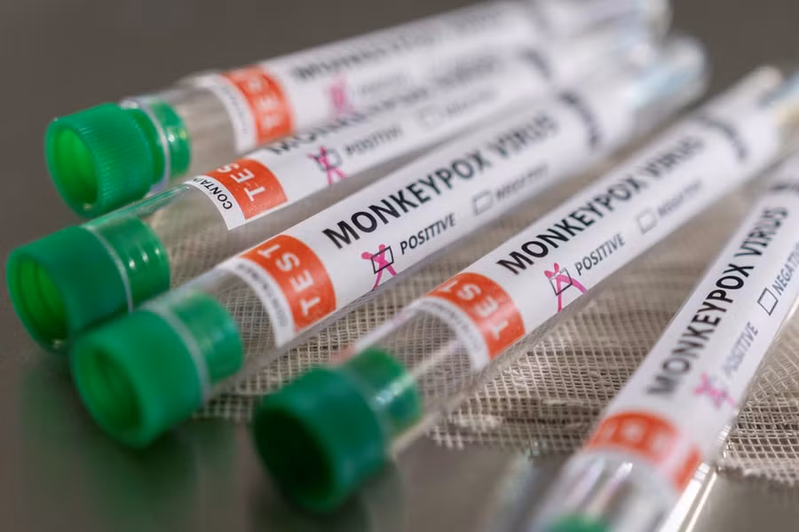 Các mẫu bệnh phẩm đậu mùa khỉ. Ảnh: REUTERS.