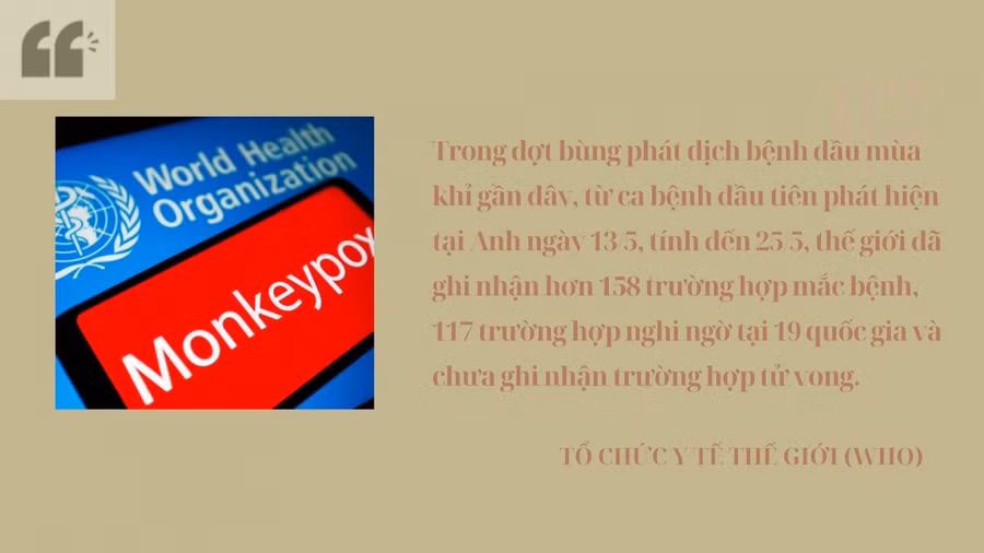 Bệnh đậu mùa khỉ không gây đại dịch như Covid-19 ảnh 3