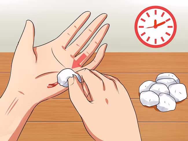 Người mắc bệnh Hemophilia có thể bị chảy máu ngay cả khi không bị chấn thương hoặc chảy máu kéo dài sau các chấn thương hay phẫu thuật. Ảnh: Nguồn internet.