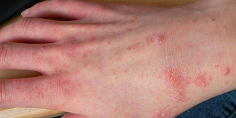 Ảnh minh họa/INT Ảnh minh họa/INT