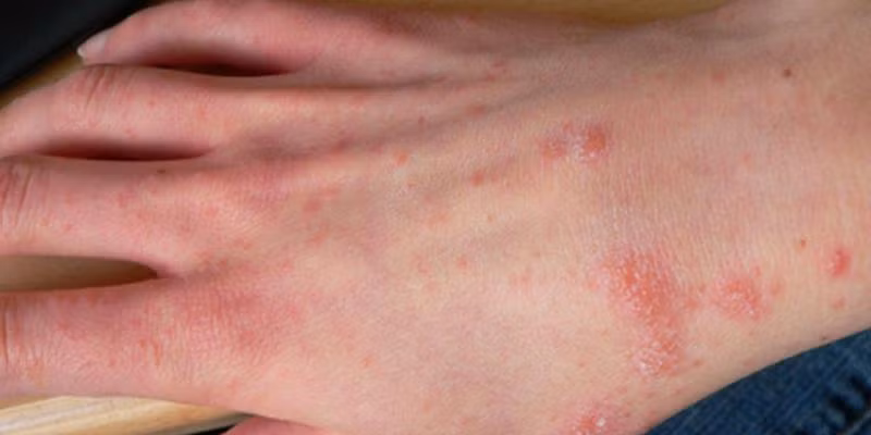 Ảnh minh họa/INT