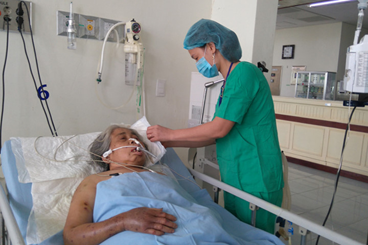 Cụ bà bị ong đốt 200 mũi "thập tử nhất sinh"