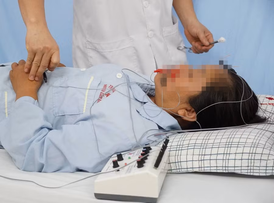 Sau 4 ngày điều trị, tình trạng liệt mặt của bệnh nhân đã được cải thiện. Ảnh: TTYT huyện Cẩm Khê.