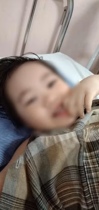 Kết quả chụp X-Quang cho thấy, bệnh nhi bị trật khớp háng bên phải, các bác sỹ khoa Chỉnh hình Nhi đã nắn chỉnh và đặt máng bột cố định tạm thời cho bé. Ảnh: AF.