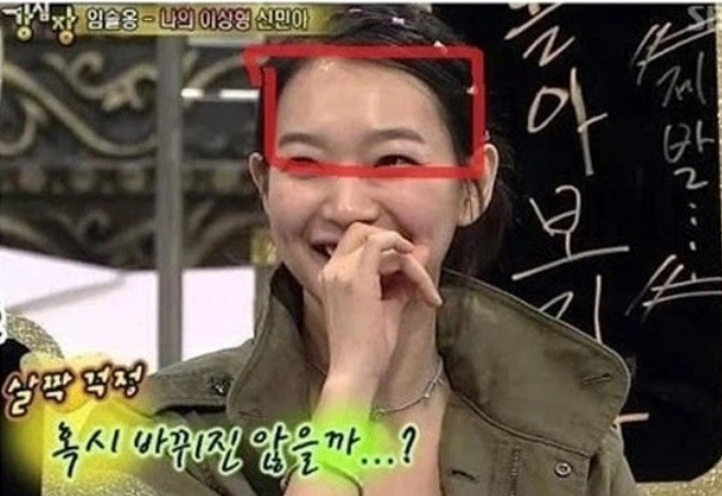 Shin Min Ah lộ bằng chứng rõ rệt cho việc sử dụng silicon trong phẫu thuật thẩm mỹ độn trán, cụ thể là phần trán nhô ra, boáng loáng. Shin Min Ah lộ bằng chứng rõ rệt cho việc sử dụng silicon trong phẫu thuật thẩm mỹ độn trán, cụ thể là phần trán nhô ra, boáng loáng.