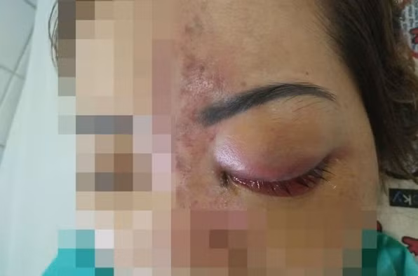 Ảnh minh họa: Infornet.