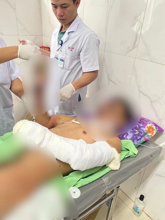 Bé trai được bác sĩ điều trị sau khi vụ nổ pháo Bé trai được bác sĩ điều trị sau khi vụ nổ pháo
