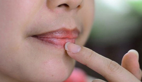 Màu sắc đôi môi cảnh báo những loại bệnh bạn đang mắc phải - Ảnh 2 Mau sac doi moi canh bao nhung loai benh ban dang mac phai - Anh 2