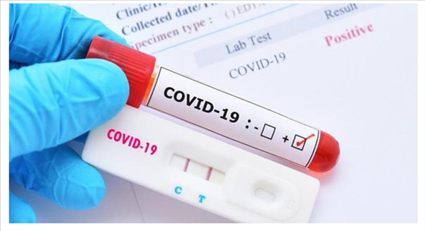 Độ nhạy của test nhanh phụ thuộc vào nồng độ virus, nhưng kém nhạy hơn PCR.