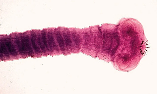 Sán dây Taenia Solium. Ảnh: CNN OrgBioScolex-8548-1421816127.jpg