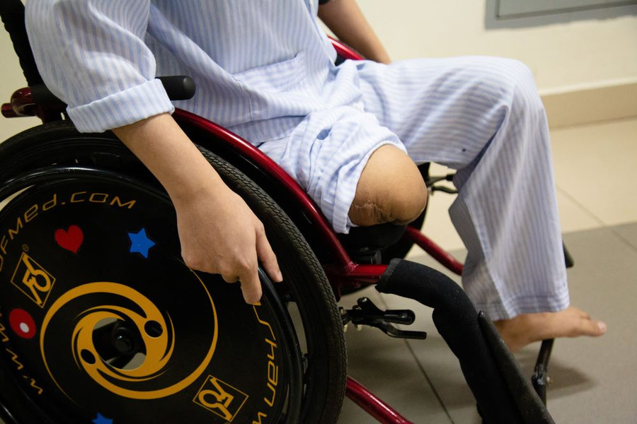 Người bệnh hemophilia nếu không được phát hiện sớm và điều trị đúng cách có thể phải chịu nhiều biến chứng nặng nề. Ảnh: BVCC. Người bệnh hemophilia nếu không được phát hiện sớm và điều trị đúng cách có thể phải chịu nhiều biến chứng nặng nề. Ảnh: BVCC.