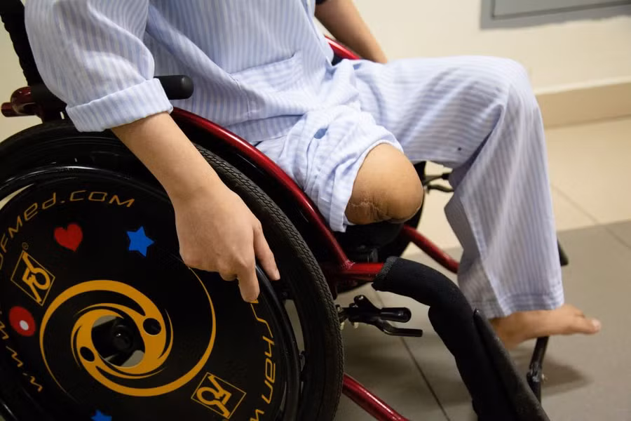 Người bệnh hemophilia nếu không được phát hiện sớm và điều trị đúng cách có thể phải chịu nhiều biến chứng nặng nề. Ảnh: BVCC.