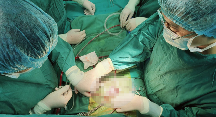 Các bác sĩ phẫu thuật dị tật bẩm sinh cho cháu N.Đ.L. Ảnh. BVCC Các bác sĩ phẫu thuật dị tật bẩm sinh cho cháu N.Đ.L. Ảnh. BVCC