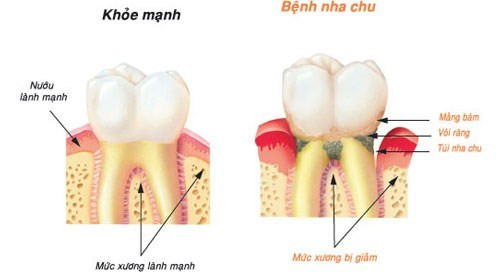 Minh họa/INT Minh họa/INT