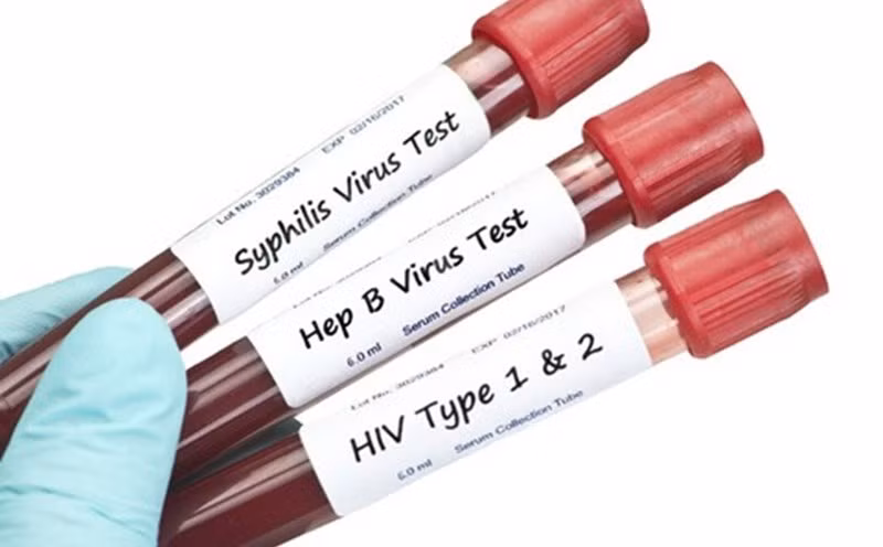 Rất nhiều mầm bệnh có thể lây qua đường tình dục. Ảnh minh họa.